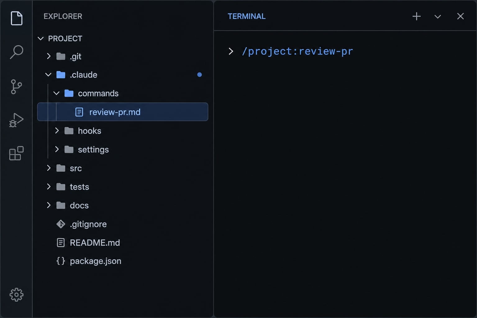 Claude Code custom commands: Create reusable slash commands